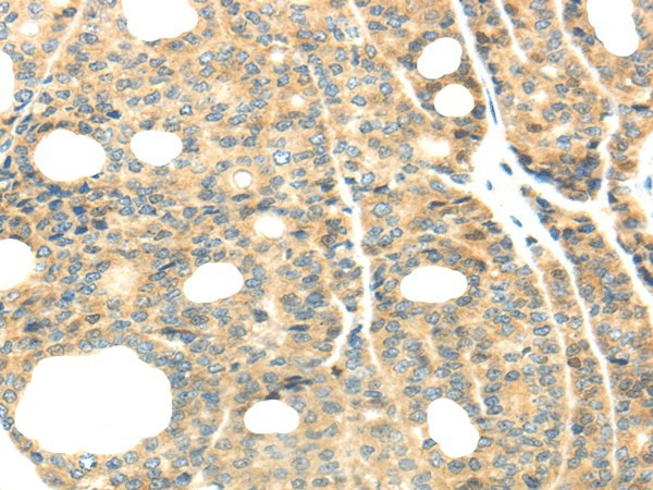 TTBK2 Polyclonal Antibody (E-AB-17480)