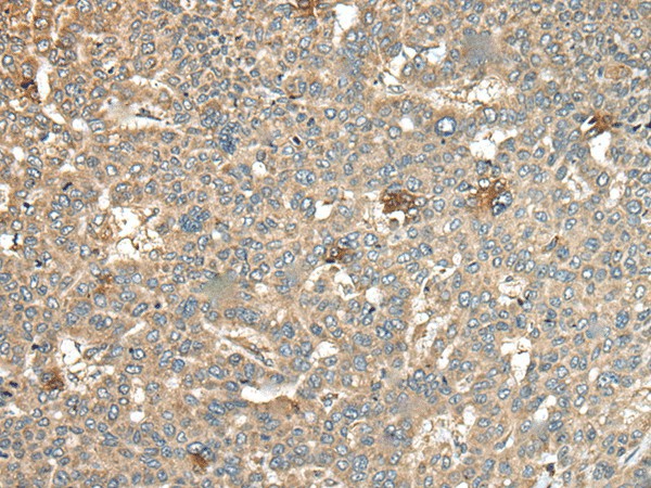 CA11 Polyclonal Antibody (E-AB-18586)