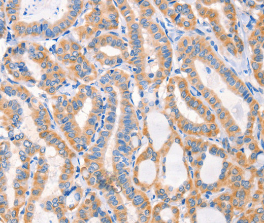 Factor XIIIa Polyclonal Antibody (E-AB-12903)