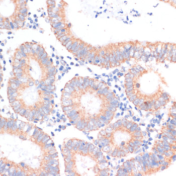 EIF4EBP1 Polyclonal Antibody (E-AB-66892)
