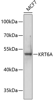 KRT6A Polyclonal Antibody (E-AB-67891)