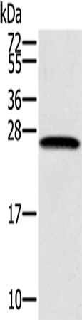 SSX1 Polyclonal Antibody (E-AB-11604)