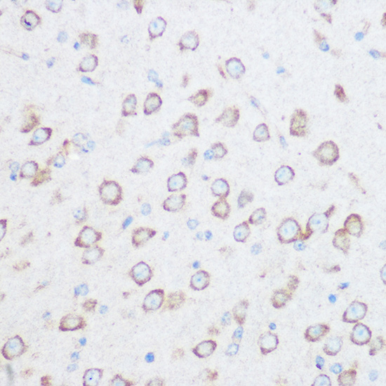 NG2/CSPG4 Polyclonal Antibody (E-AB-93349)