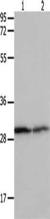 14-3-3 beta/alpha Polyclonal Antibody (E-AB-15795)