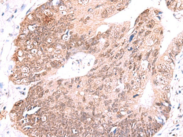 RUSC1 Polyclonal Antibody (E-AB-52951)