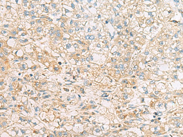 EIF4E2 Polyclonal Antibody (E-AB-53109)