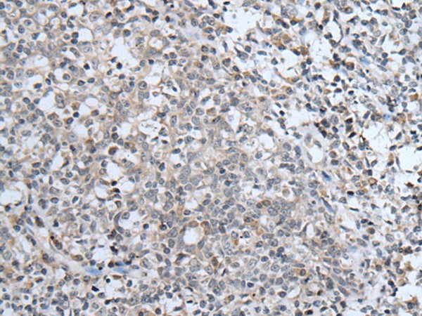 ABCA6 Polyclonal Antibody (E-AB-19529)