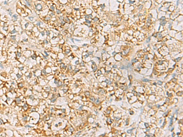 HLA-DQB2 Polyclonal Antibody (E-AB-53101)