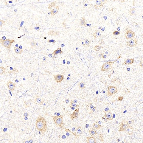 NTRK2 Polyclonal Antibody (E-AB-70156)