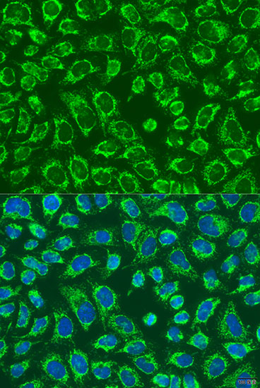 MAP4K5 Polyclonal Antibody (E-AB-66434)