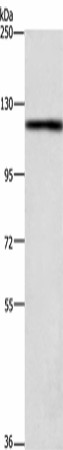 TSPYL2 Polyclonal Antibody (E-AB-16342)