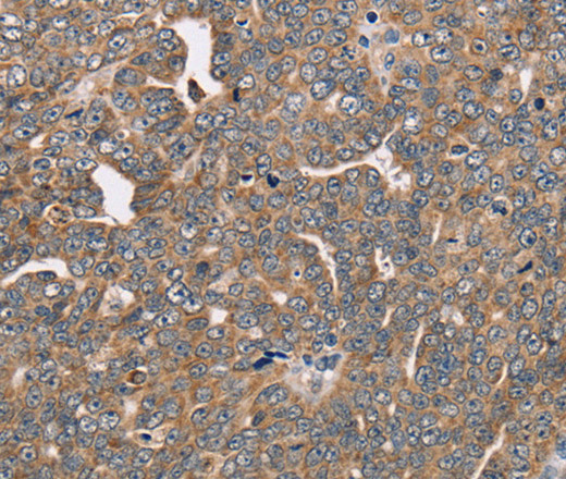 FAIM2 Polyclonal Antibody (E-AB-11211)
