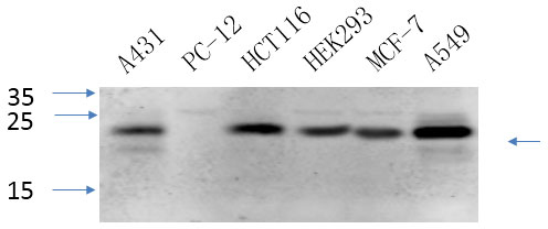 CAV1 Polyclonal Antibody (E-AB-30778)