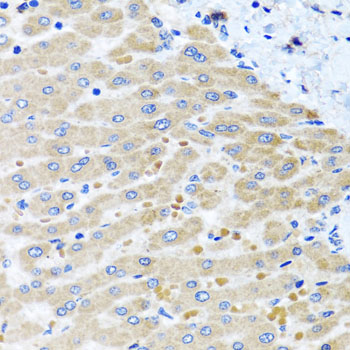 DARS2 Polyclonal Antibody (E-AB-62471)