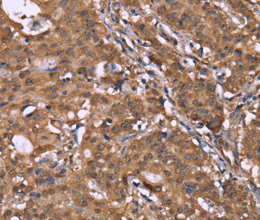 HLTF Polyclonal Antibody (E-AB-16481)