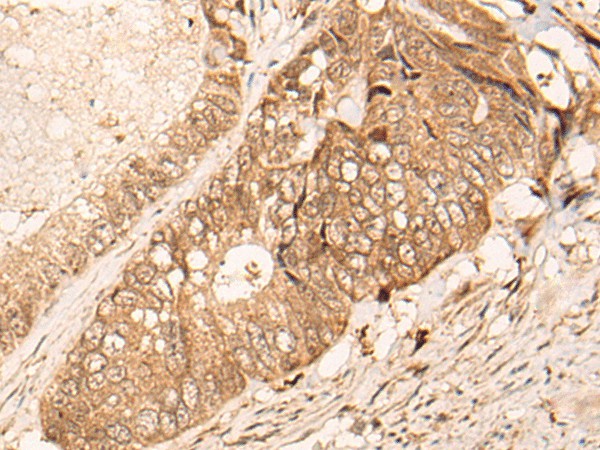 HIPK3 Polyclonal Antibody (E-AB-19326)