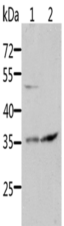 SOCS1 Polyclonal Antibody (E-AB-15855)