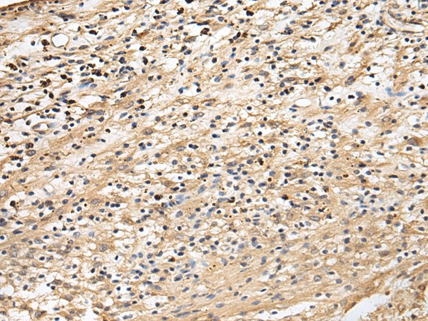 CRACR2A Polyclonal Antibody (E-AB-19269)