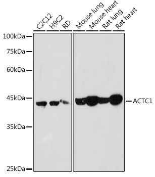 ACTC1 Polyclonal Antibody (E-AB-92725)