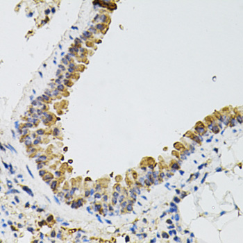 ARHGEF2 Polyclonal Antibody (E-AB-65930)