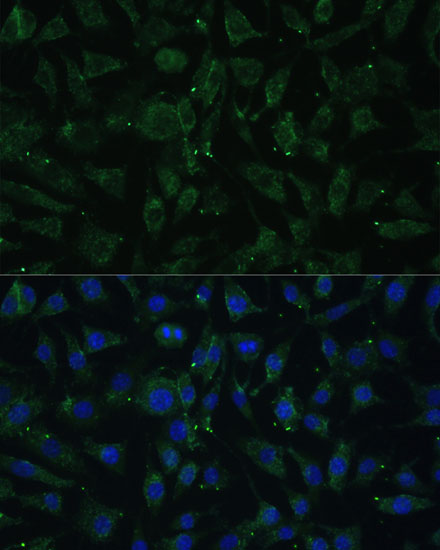 APH1A Polyclonal Antibody (E-AB-65068)