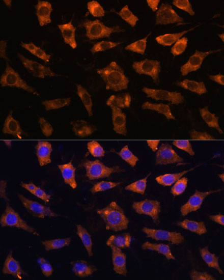 CYR61 Polyclonal Antibody (E-AB-65800)