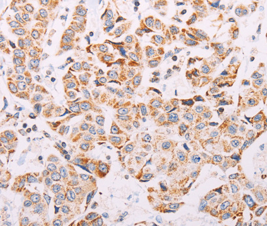 ADAMTS16 Polyclonal Antibody (E-AB-12948)