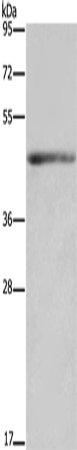 IL5RA Polyclonal Antibody (E-AB-16515)