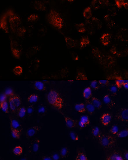 ACOT9 Polyclonal Antibody (E-AB-65308)
