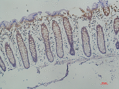Galectin 3 Monoclonal Antibody (E-AB-22183)