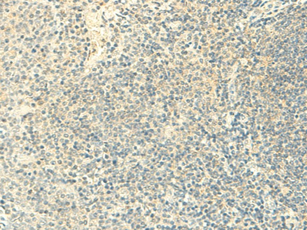 FMNL2 Polyclonal Antibody (E-AB-52830)