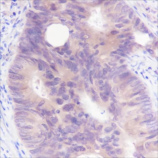 Recombinant SETBP1 Monoclonal Antibody (AN301656L)