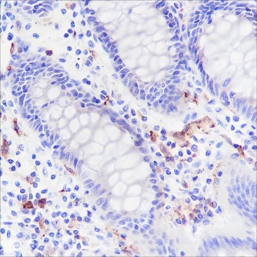 Recombinant CD169 Monoclonal Antibody (AN301466L)