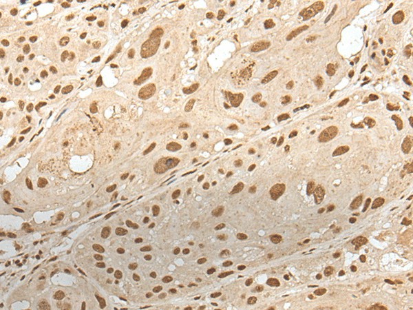 ZNF274 Polyclonal Antibody (E-AB-52381)