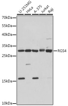 RGS4 Polyclonal Antibody (E-AB-67253)