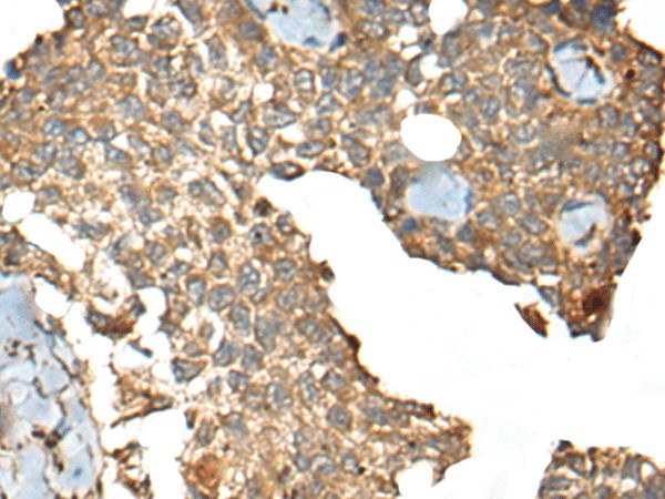 CCDC113 Polyclonal Antibody (E-AB-52521)