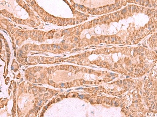 CDC20 Polyclonal Antibody (E-AB-19066)