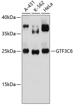GTF3C6 Polyclonal Antibody (E-AB-90621)