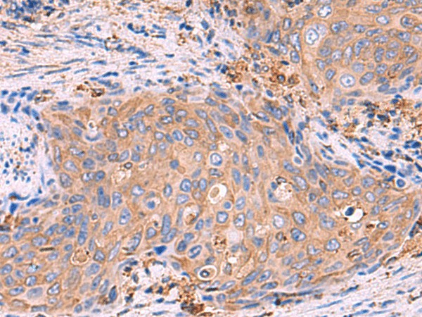 G6PC Polyclonal Antibody (E-AB-52080)