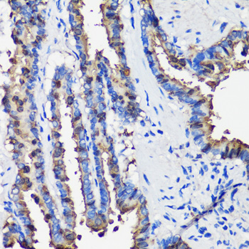 SCGB1A1 Polyclonal Antibody (E-AB-67011)