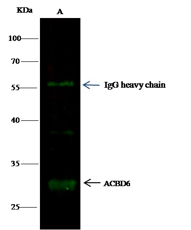 ACBD6 Monoclonal Antibody (AN200206P)