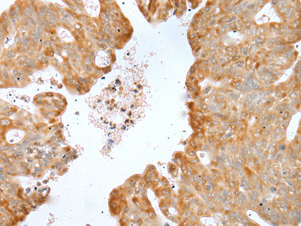 P2RY4 Polyclonal Antibody (E-AB-19441)