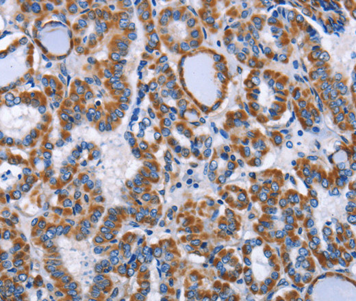 INTS10 Polyclonal Antibody (E-AB-14639)