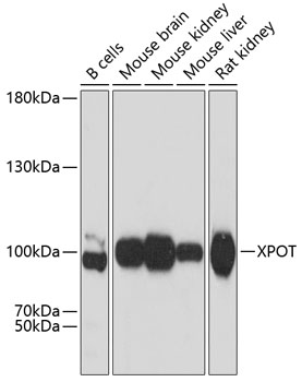 XPOT Polyclonal Antibody (E-AB-63616)