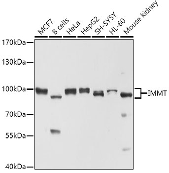 IMMT Polyclonal Antibody (E-AB-60780)