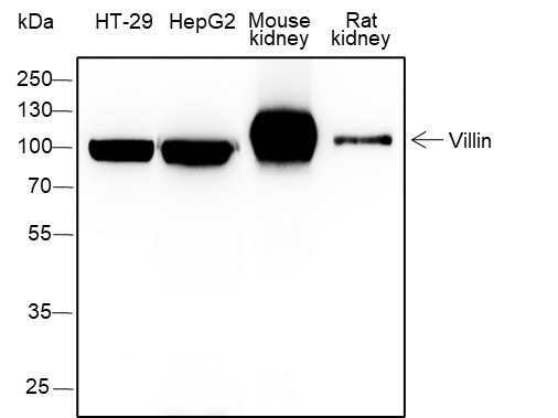 Recombinant Villin Monoclonal Antibody (AN301684L)