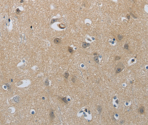 NPR1 Polyclonal Antibody (E-AB-15504)