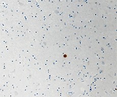 Purified anti-α-Synuclein Phospho (Tyr39) Antibody (849201)