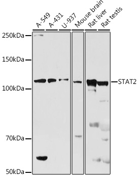 STAT2 Polyclonal Antibody (E-AB-93129)