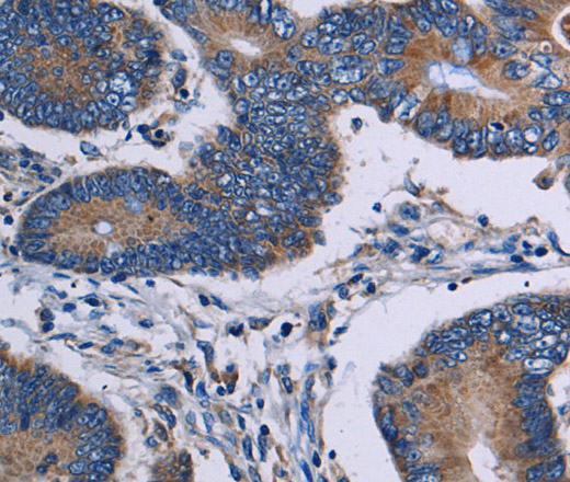 ITK Polyclonal Antibody (E-AB-15142)